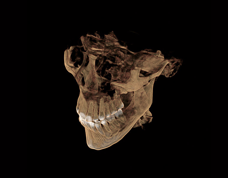 3D cone beam imaging