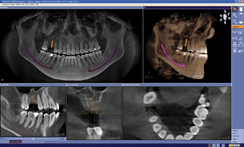 3D cone beam imaging